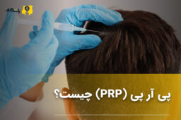 پی آر پی (PRP) چیست؟
