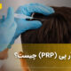 پی آر پی (PRP) چیست؟