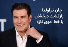 چهره‌های معروفی که از پروتز مو استفاده می‌کنند و شما نمی‌دانید!